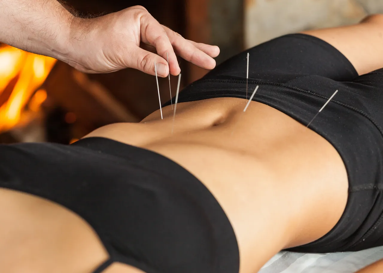 Co wchodzi w skład zabiegu akupunktury