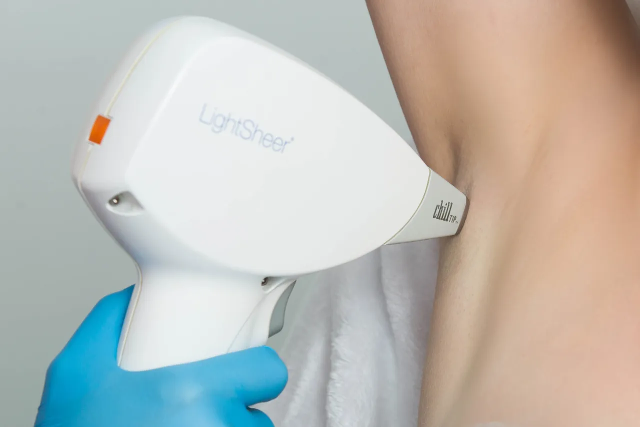 fototypy skóry depilacja laserowa