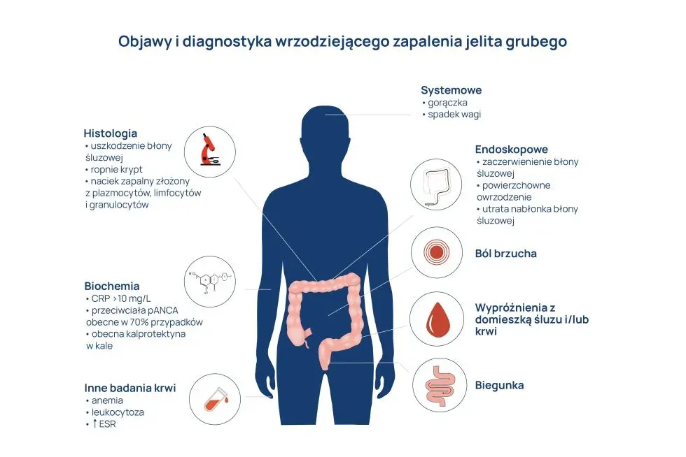 Objawy zaburzeń jelitowych infografika