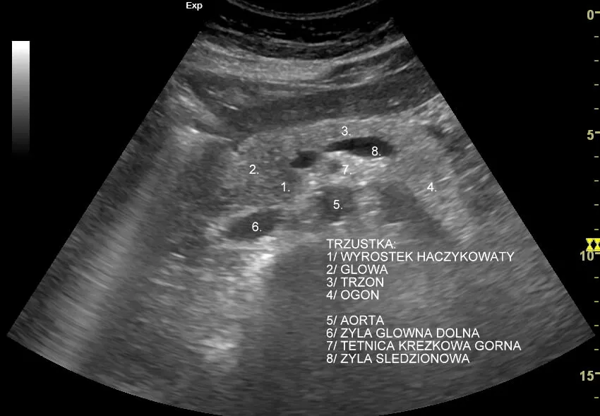 badanie USG jamy brzusznej trzustka