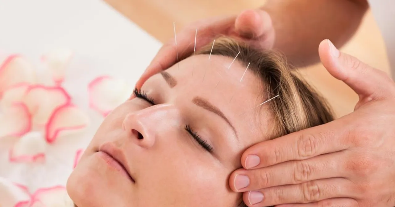 akupunktura igły zabieg