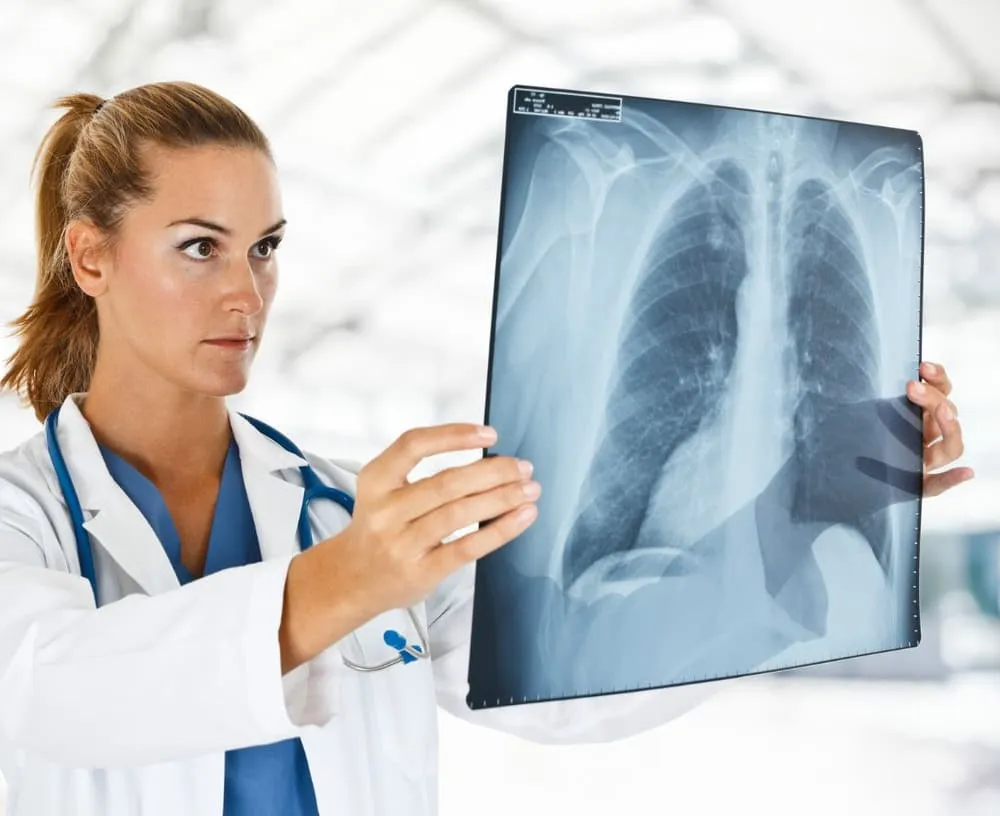 lekarz przepisuje leki na zapalenie płuc