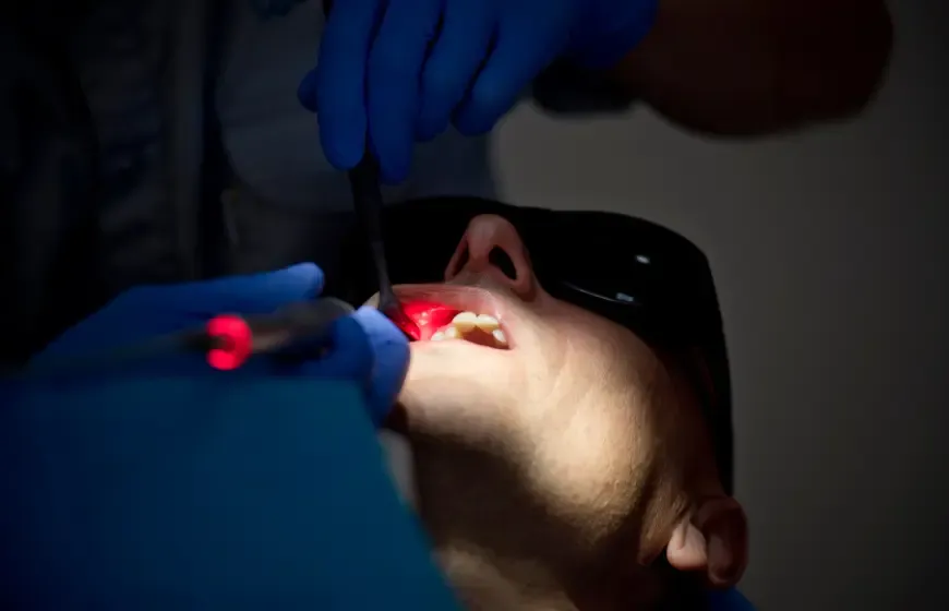 Laserowe leczenie afty w jamie ustnej