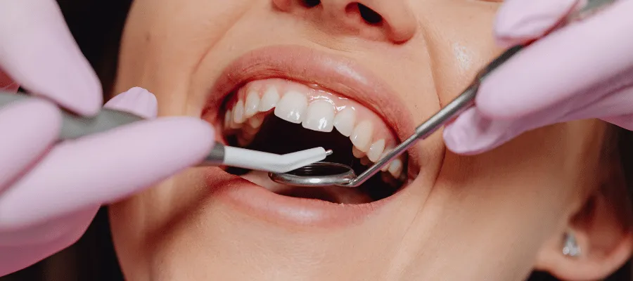 dentysta usuwanie szwów dziąsło narzędzia