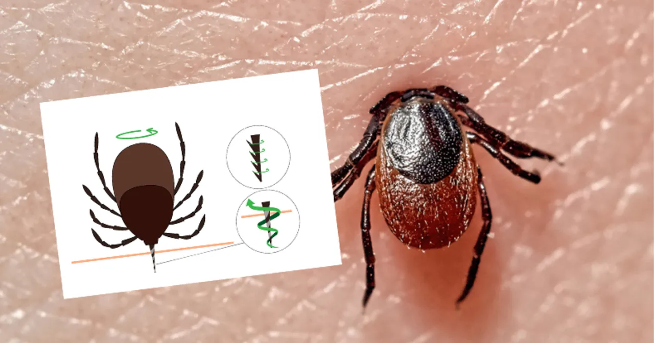 Niebezpieczne metody usuwania kleszczy przekreślone