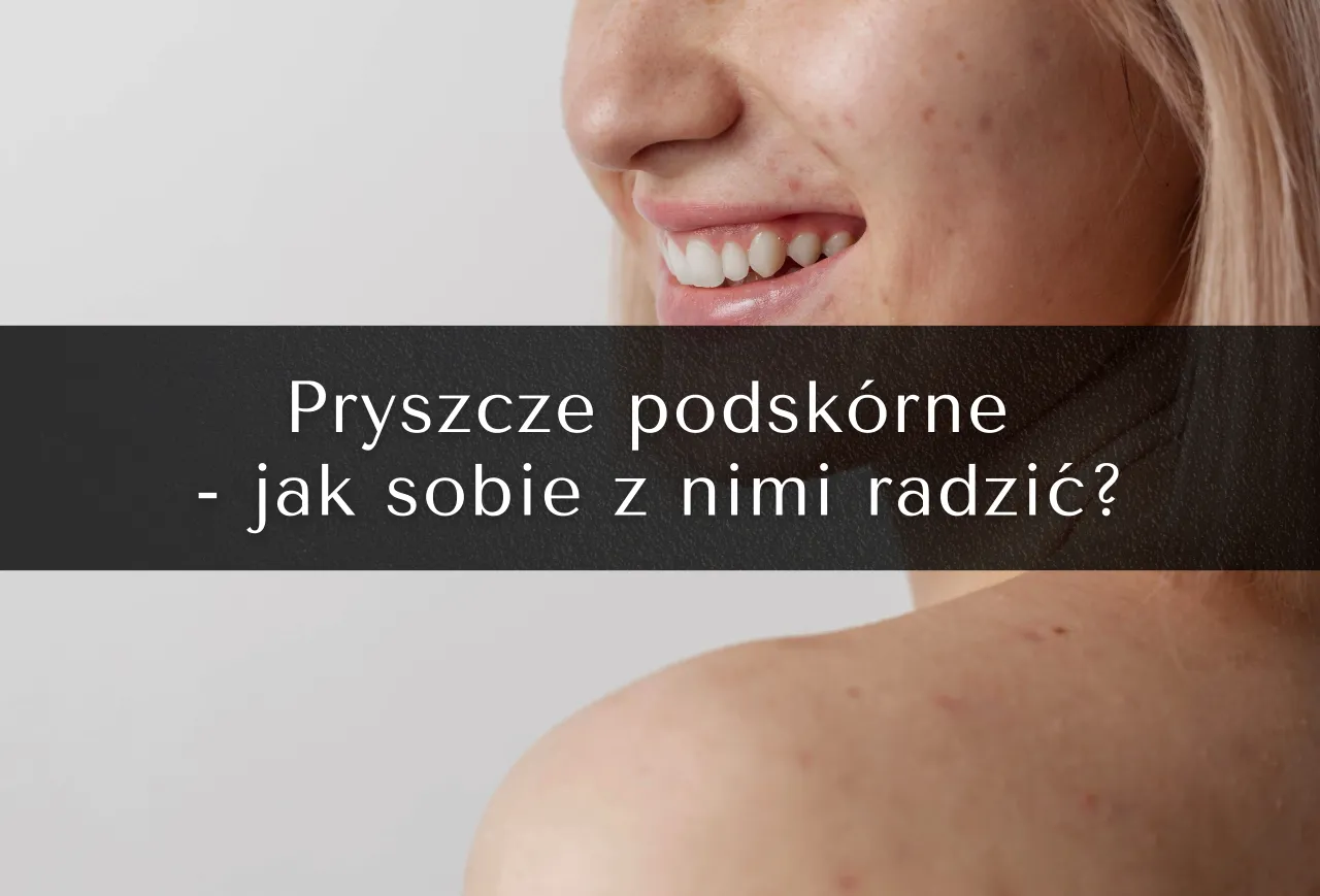 pryszcz podskórny budowa skóry