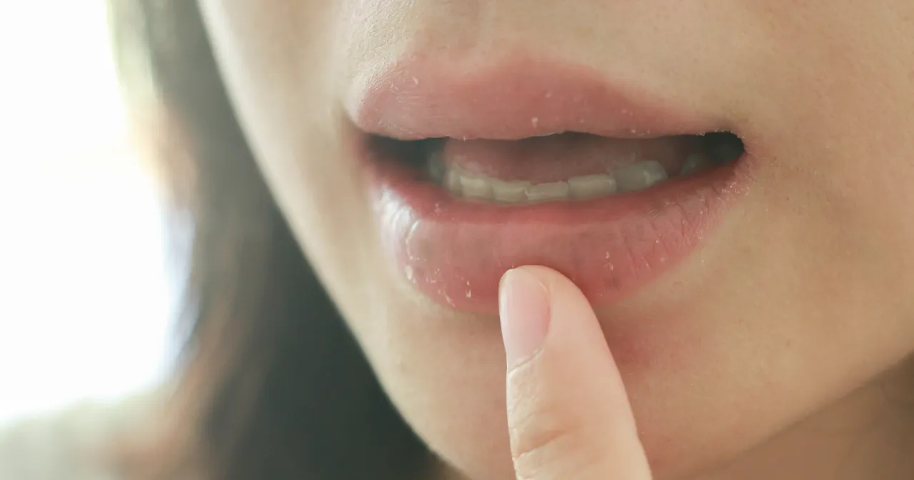 Objawy cukrzycy w jamie ustnej