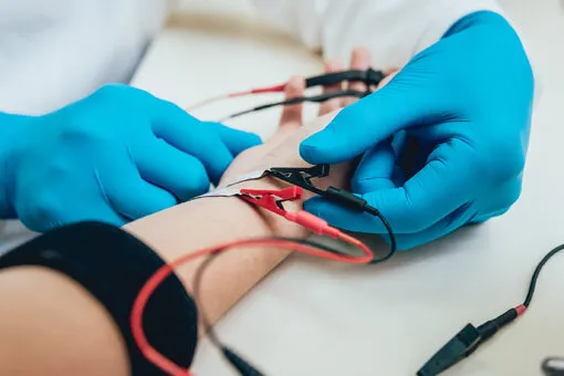 Badanie EMG przebieg, elektroneurografia, igła EMG