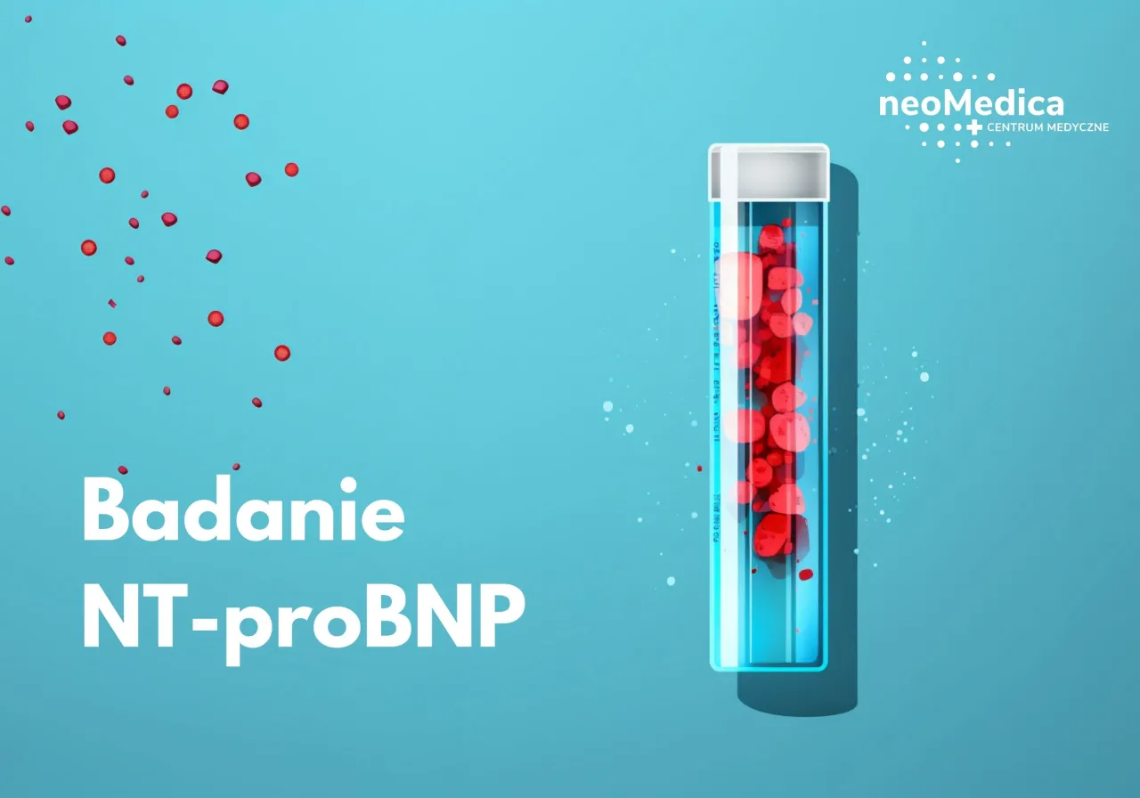 NT-proBNP badanie serca