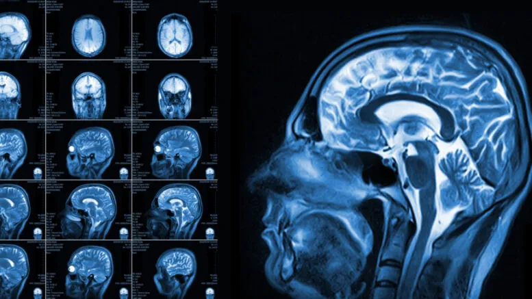 porównanie rezonans NFZ prywatnie