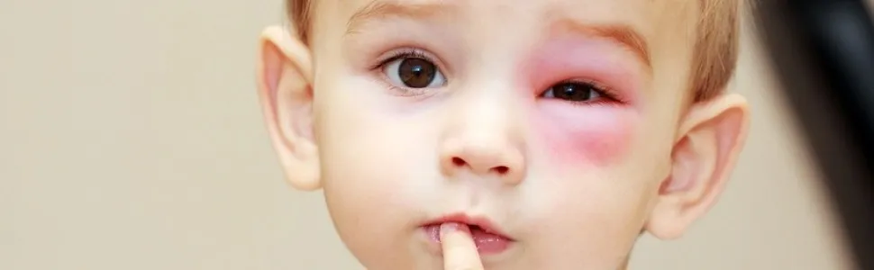 objawy zespołu dziecka maltretowanego