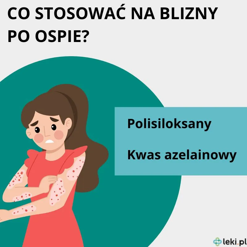 Zdjęcie Skuteczne sposoby na blizny po ospie u dzieci - bezpieczne metody