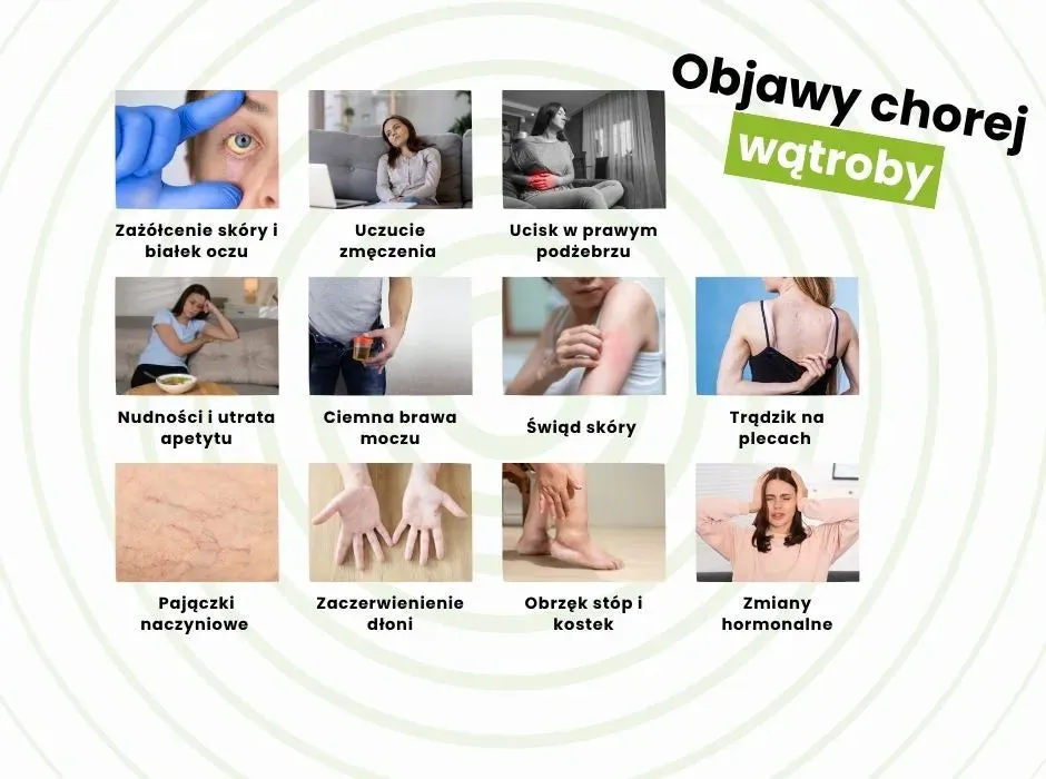 Objawy chorej wątroby, b&oacute;l brzucha, zmęczenie