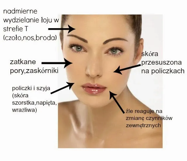 skóra mieszana strefa T policzki