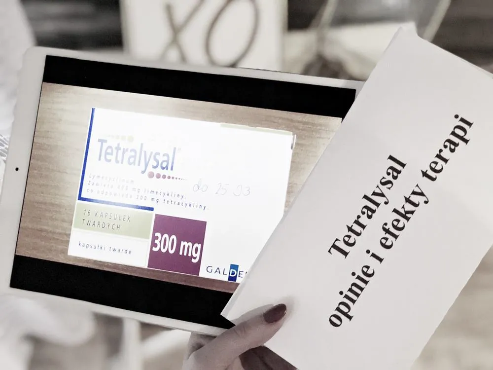 Zdjęcie Skutki uboczne po odstawieniu Tetralysal – co musisz wiedzieć?