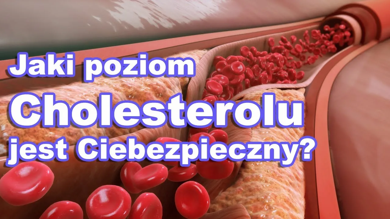 Zdjęcie Jaki poziom cholesterolu jest groźny? Normy, ryzyko i jak go obniżyć
