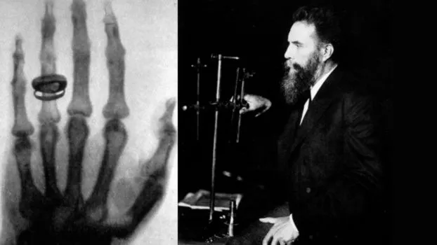 Zdjęcie Wilhelm Roentgen i jego wynalazek: jak promienie X zmieniły medycynę