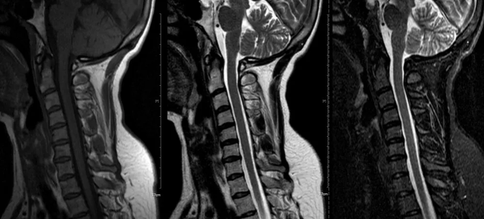 por&oacute;wnanie obraz&oacute;w rtg tk mri