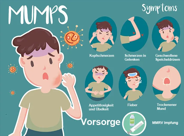 Mumps Symptome Ohrspeicheldr&uuml;senschwellung