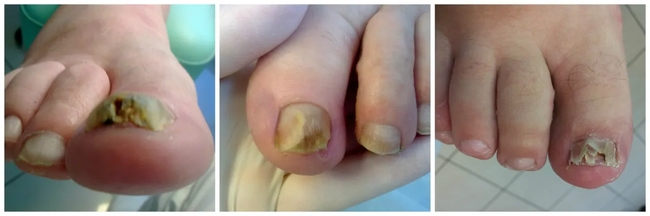 Współpraca dermatolog podolog