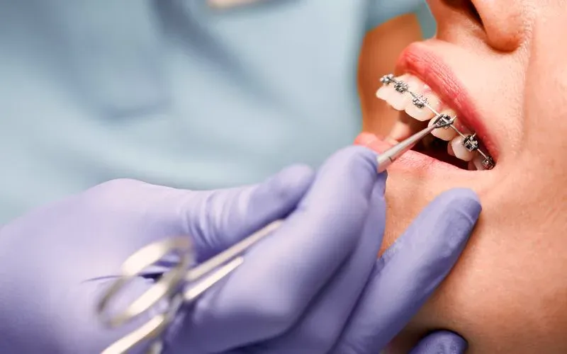 Ortodonta wykonujący diagnostykę przed aparatem