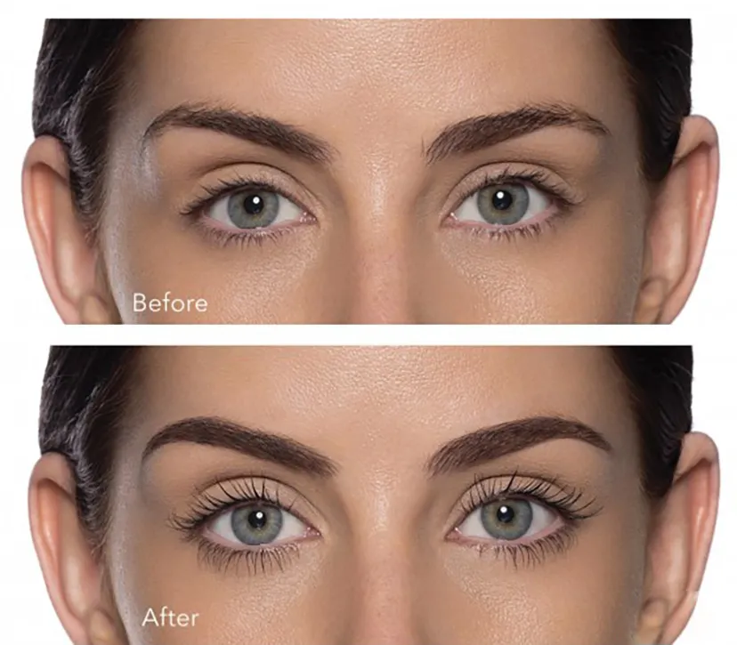 botoks rzęs efekty przed i po