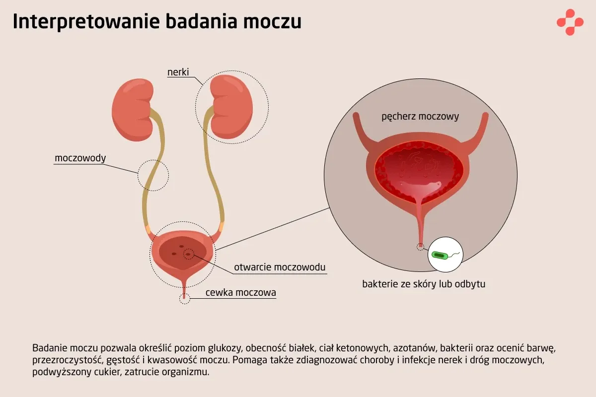 kobieta zastanawia się nad badaniem krwi i moczu podczas okresu