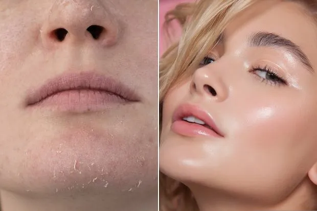 kobieta z suchą cerą przed makijażem, suche skórki