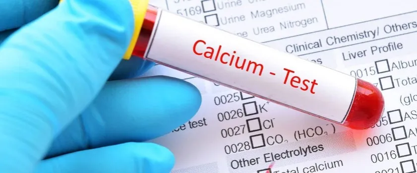 badanie krwi wapń