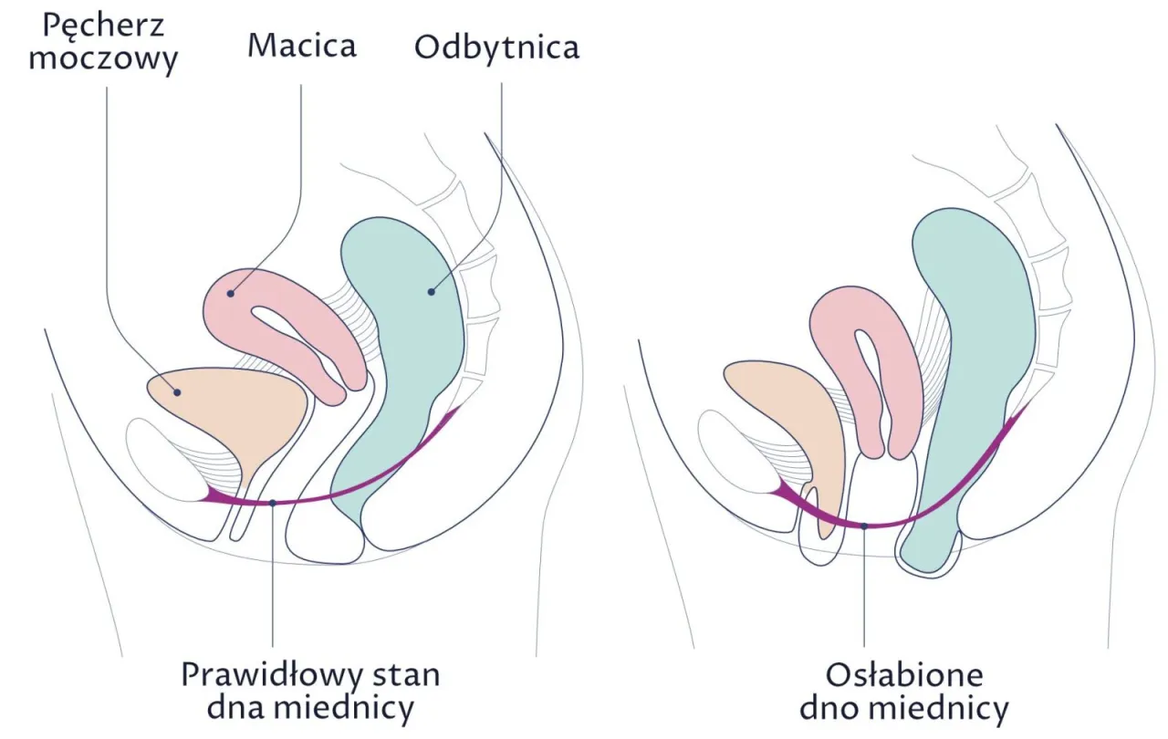 Kobieta w ciąży, kobieta w średnim wieku, ilustracja dna miednicy