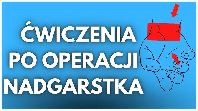 ćwiczenia mobilizujące bliznę po operacji nadgarstka, ćwiczenia wzmacniające chwyt po operacji cieśni nadgarstka