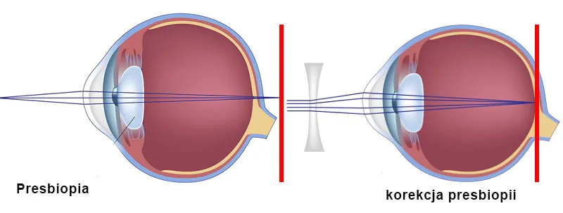 Porównanie specjalistów wzroku infografika