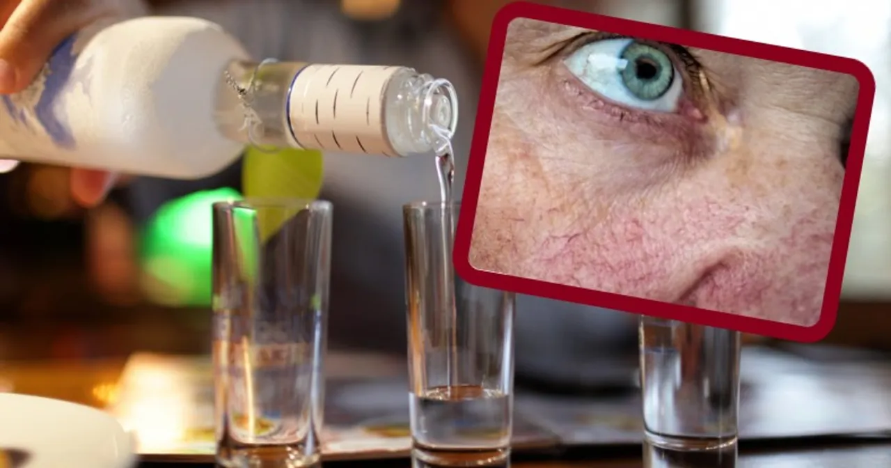 przyczyny ziemistej cery infografika