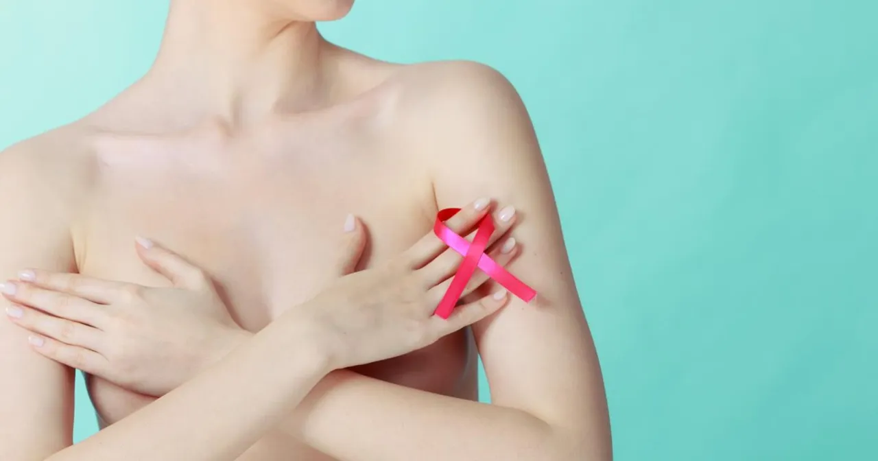 Ilustracja przedstawiająca torbiel piersi wchłaniającą się