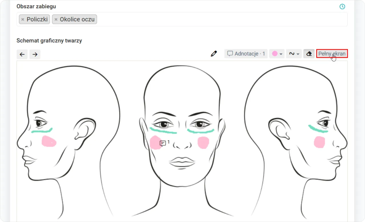 kalendarz odliczanie dni po zabiegu medycyny estetycznej