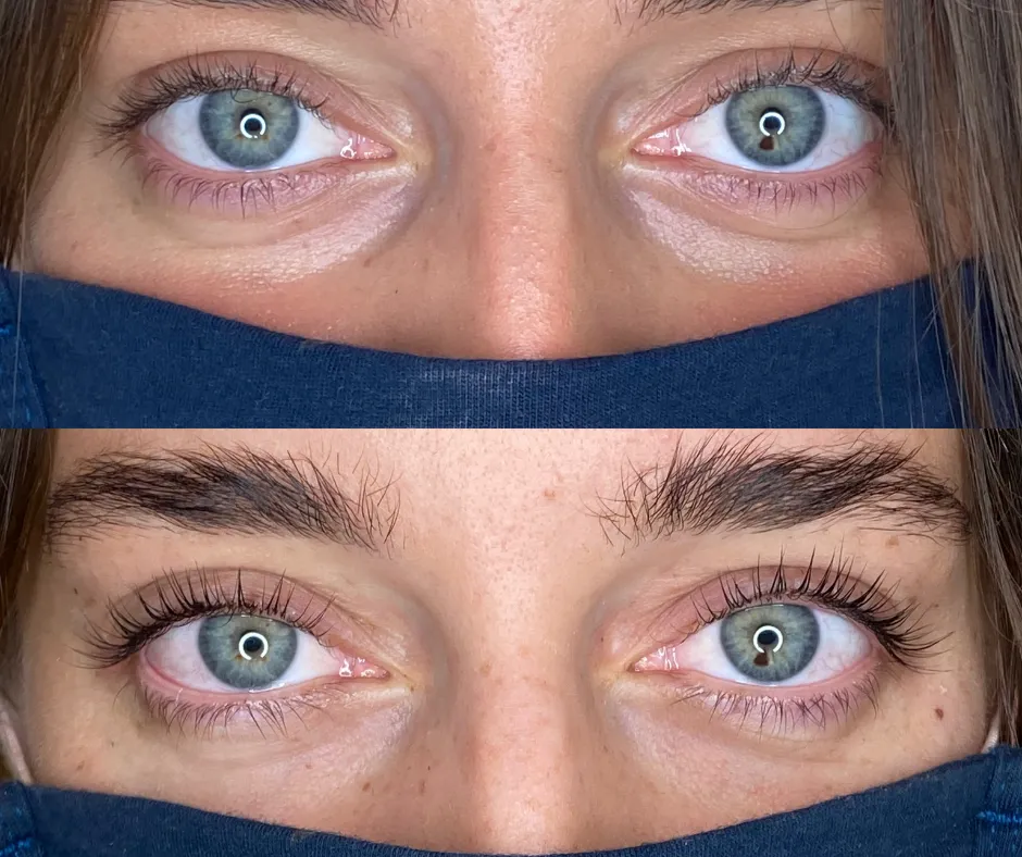 uszkodzone rzęsy po laminacji