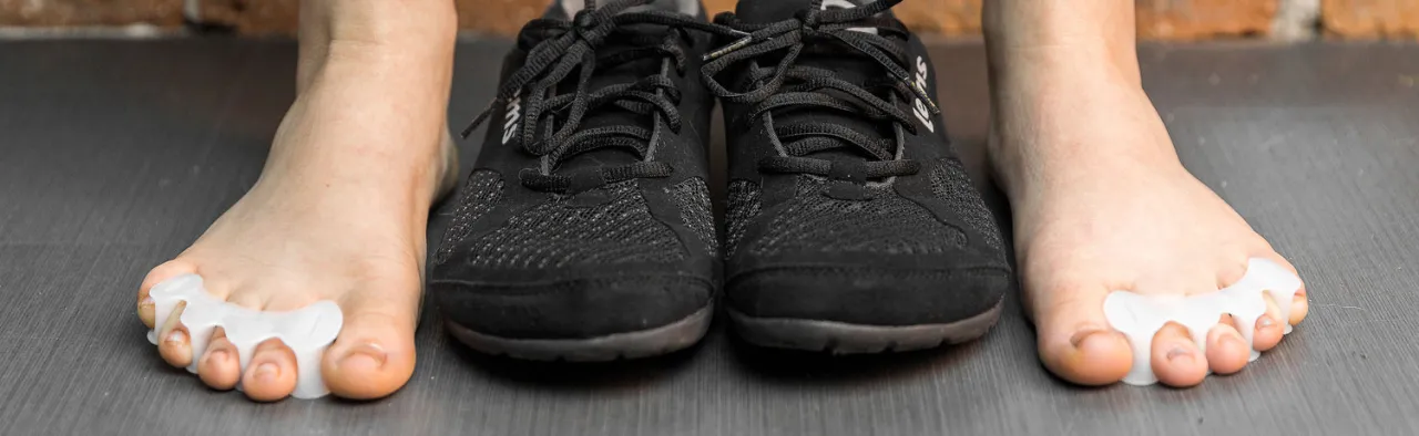 buty szkodliwe dla stóp haluksy