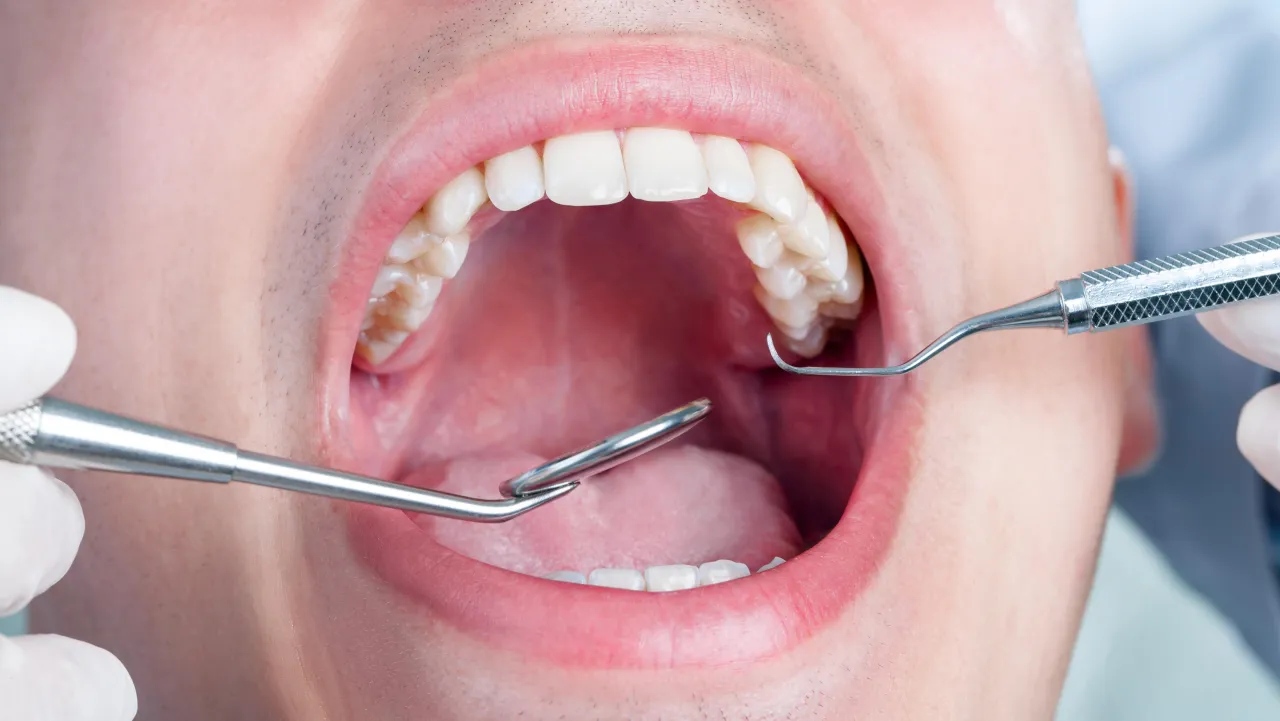 zdrowa jama ustna profilaktyka