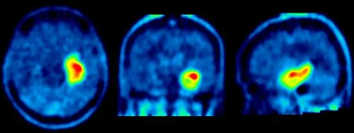 Nuklearmedizinische Untersuchungsger&auml;te PET SPECT Szintigraphie