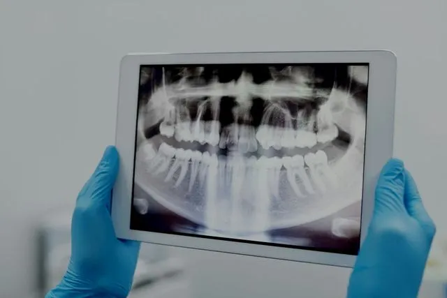 por&oacute;wnanie dawki promieniowania rtg do codziennych źr&oacute;deł