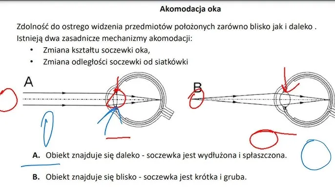 dalekowzroczność mechanizm oko schemat