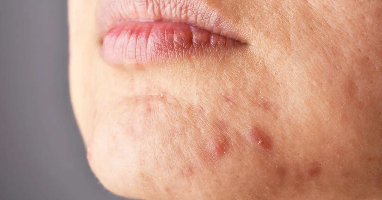 kobieta patrzy w lustro zmęczona cera