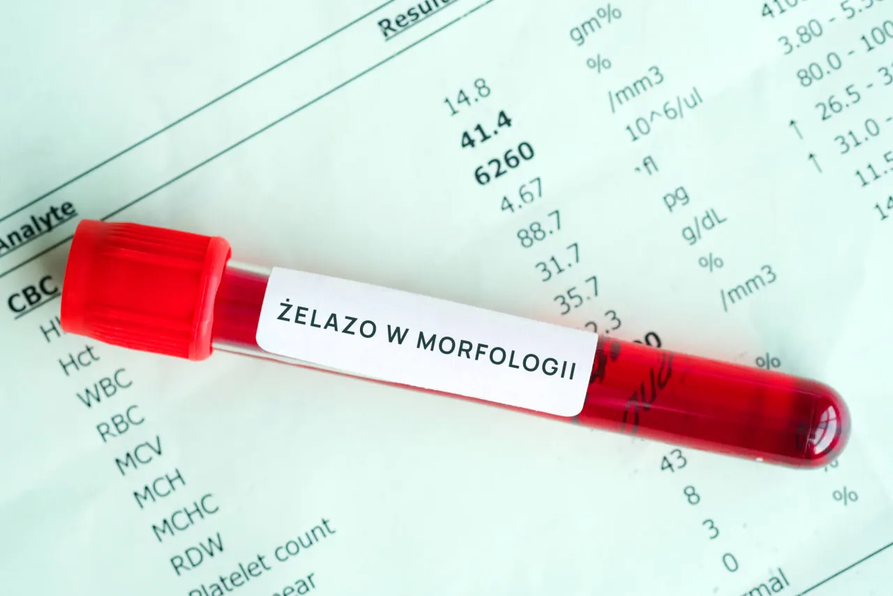 badania krwi niedob&oacute;r żelaza, ferrytyna morfologia
