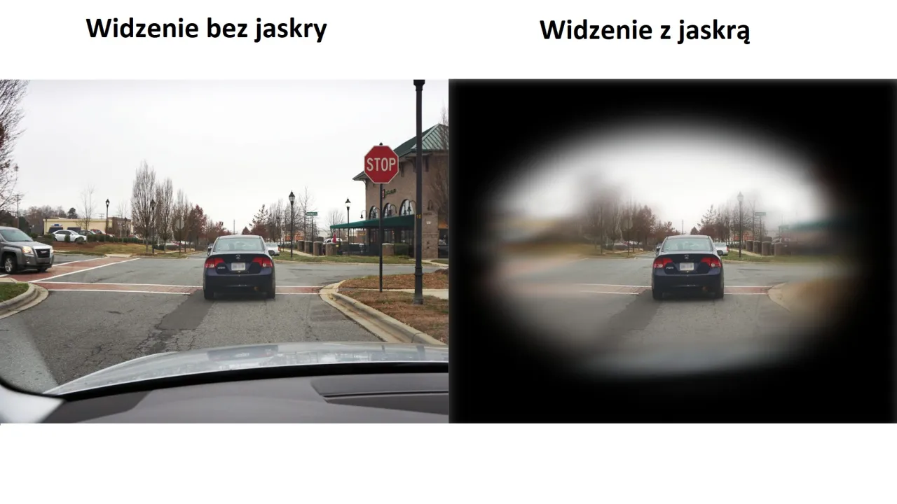 jaskra widzenie tunelowe