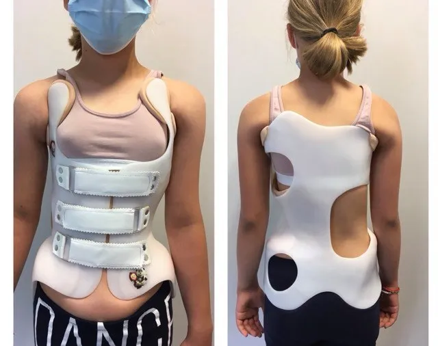 gorset ortopedyczny skolioza dzieci