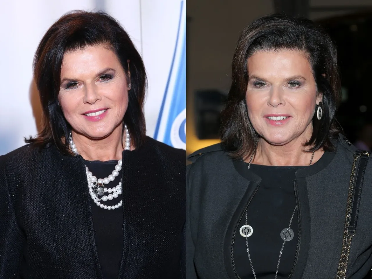 Alicja Resich-Modlińska, znana z walki z chorobą, prezentuje się w dwóch stylizacjach.