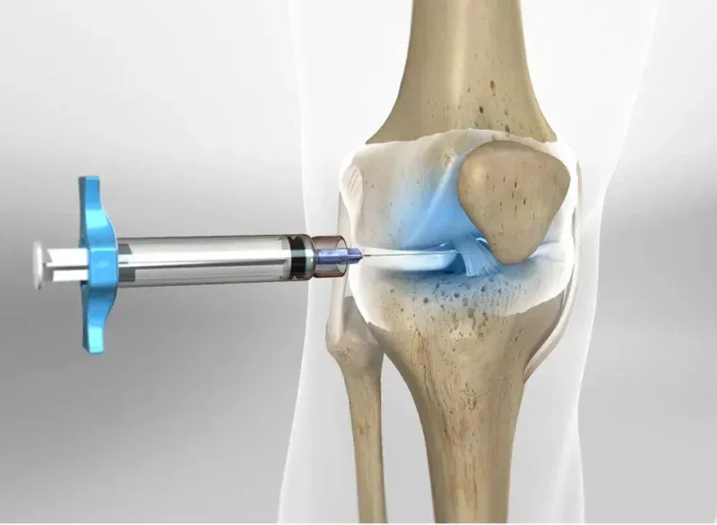 Zastrzyk dostawowy kwas hialuronowy