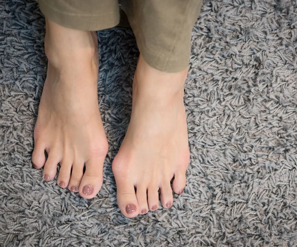 Biegacz na miękkim podłożu po operacji stopy