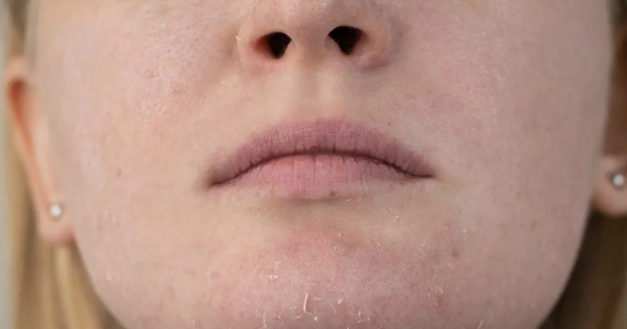 skóra z niedoborem witamin i minerałów