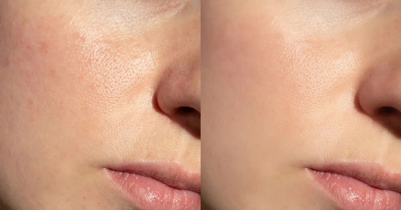 krem bb na sk&oacute;rze efekt naturalny